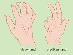 De man die door een raam viel