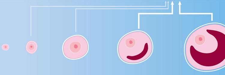 Menopauze, arbeid en zorg; een werkbare combinatie?