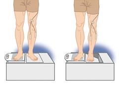 Is oefentoltraining zinvol bij functionele instabiliteit van de enkel?