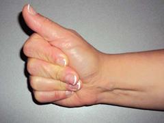 Functionele anatomie van de hand en pols