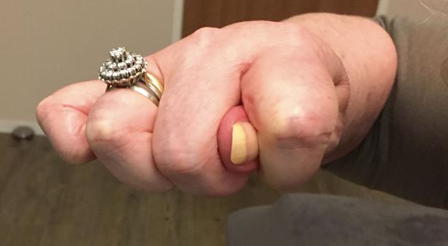 Functionele neurologische stoornissen