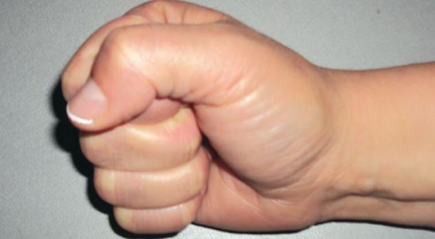 Functionele anatomie van de hand en pols