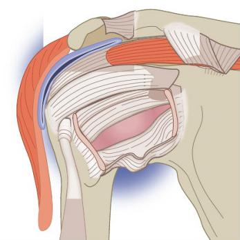Stabiliteit van de schouder