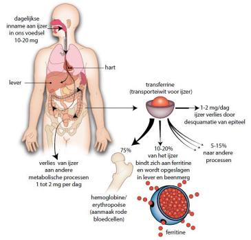 Hemochromatose