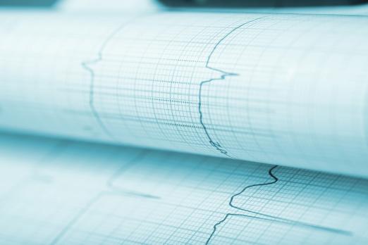 Behandeling perioperatieve myocardiale ischemie