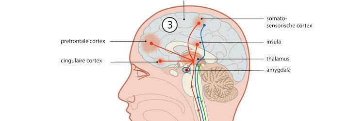 De invloed van triggerpointtherapie op het endogeen pijndempend systeem