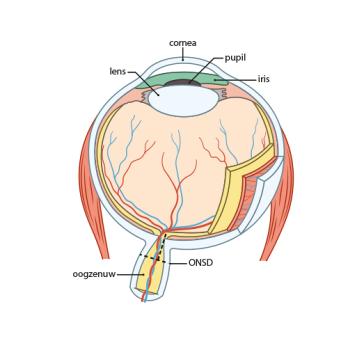 Screening op intracraniële drukverhoging 