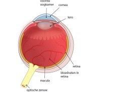 Leeftijdgebonden maculadegeneratie