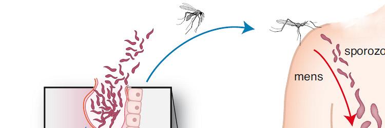 Ernstige malaria tropica op een Nederlandse IC