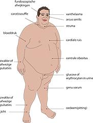 Medicamenteuze behandeling van het metabool syndroom