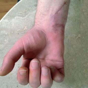 De man die door een raam viel