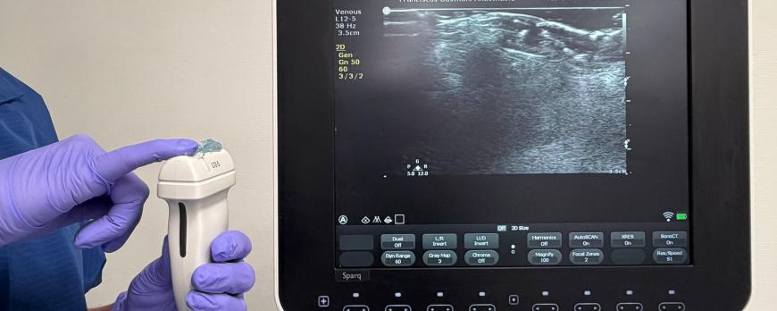 Echogeleide perifere intraveneuze canulatie