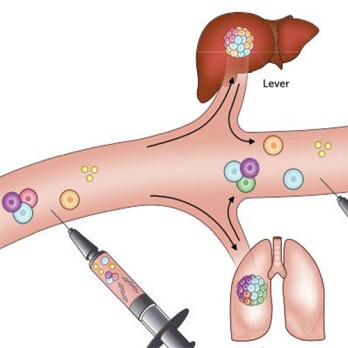 Liquid biopsy: evolutie in de oncologie 