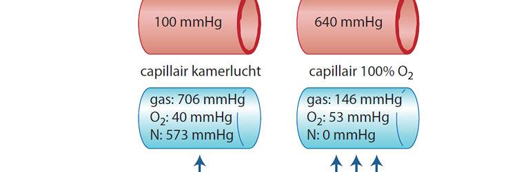 Lucht voor meer lucht, of toch zuurstof? De effectiviteit van zuurstof bij een spontane pneumothorax