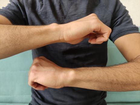 Artrokinematica en diagnostiek van specifieke carpale instabiliteit (VI)