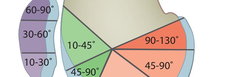 Kraakbeenletsel van de knie: operatieve opties en nabehandeling