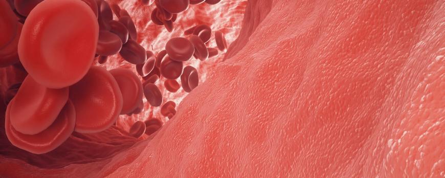 Anesthesiologische overwegingen bij endovasculaire aortachirurgie