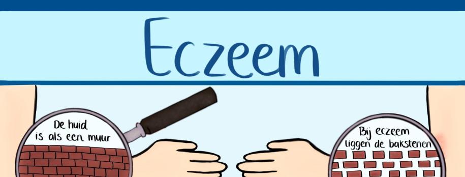 Infographic eczeem