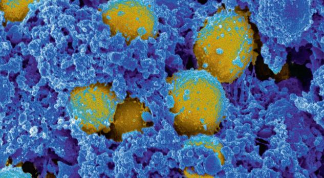 Ernstige infectieziekten bij kinderen