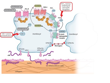 Trombocytenaggregatieremming na een TIA of herseninfarct