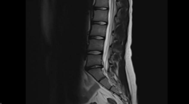 Relevantie van beeldvorming in de diagnostiek van veelvoorkomende orthopedische klachten (BG)