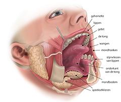 Mondzorg bij mensen met een psychotische stoornis