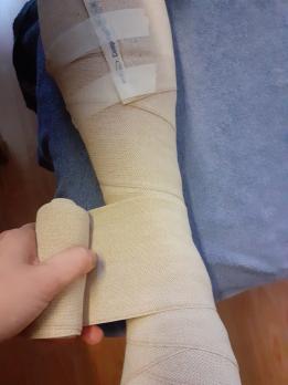 Compressietherapie