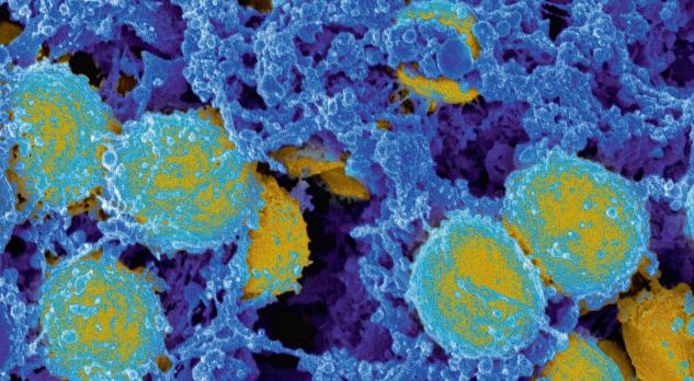 Ernstige infectieziekten bij kinderen