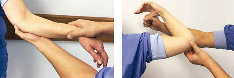 Diagnostische dilemma’s, behandeling en verwijsbeleid bij elleboogklachten