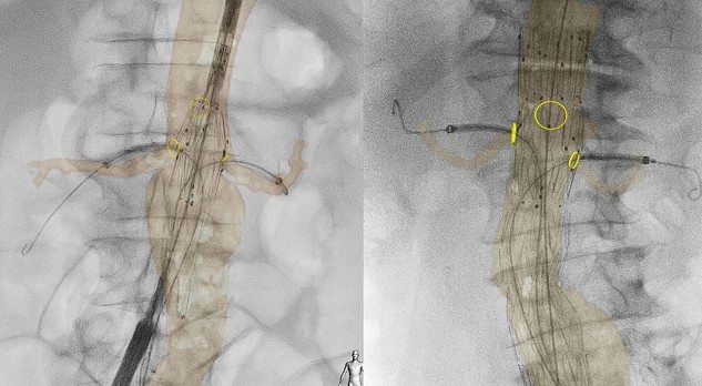 Intraoperatieve imaging