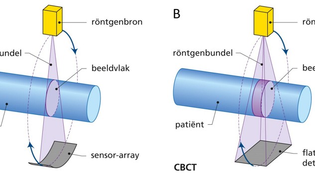 Rol van CBCT in de maxillofaciale en de algemene radiologie 