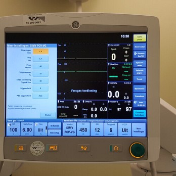 Autotriggering op cardiogene oscillaties bij dynamische circulatie 