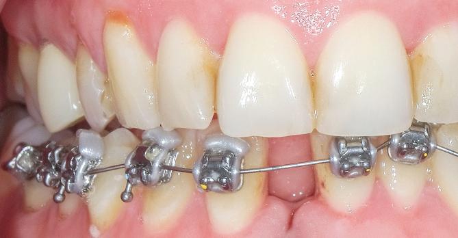 Orthodontie en de algemeen practicus