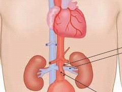 Het aneurysma van de abdominale aorta