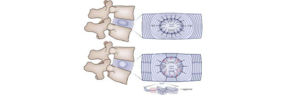 Het 'zware' leven van de lumbale disci intervertebrales (VI)