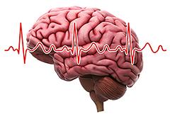 Schizofrenie en het brugadasyndroom