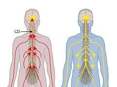 Fysiotherapie bij centrale sensitisatiepijn: bottom-up- of top-downbehandeling?