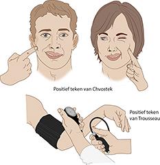 Diagnostiek bij een ontregeling van het calciummetabolisme