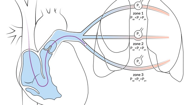 De moderne pulmonary artery catheter 