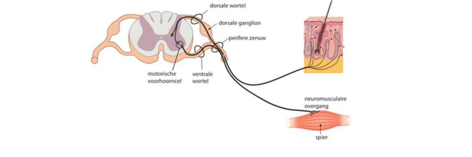 Langzaam progressieve spierziekten op volwassen leeftijd: aandachtspunten voor de fysiotherapeut (VI)