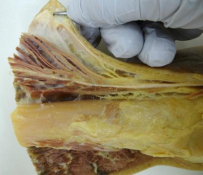 Bindweefsel en mobilisatie