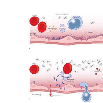 Hemodynamische monitoring bij abdominale chirurgie 