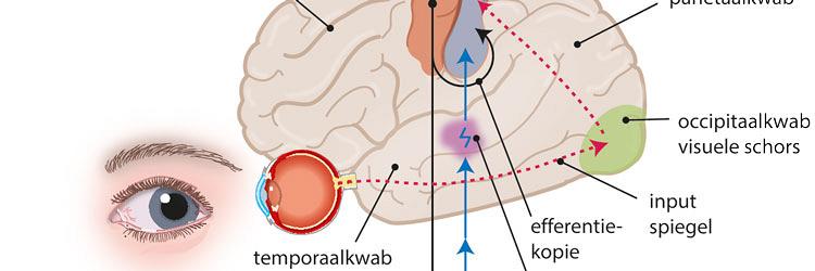 Veranderingen in het lichaamsschema na een CVA