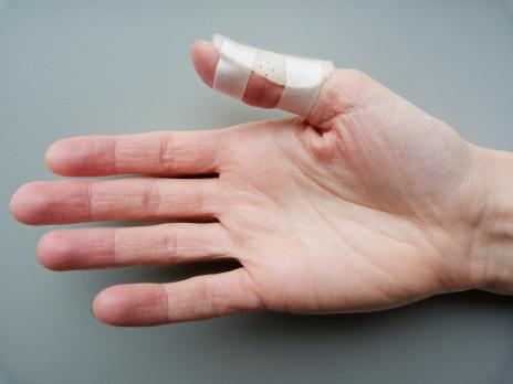Handtherapie bij reumatoïde artritis (VI)