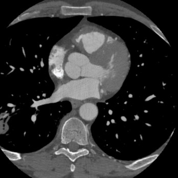 Kritieke en onverwachte bevindingen in de radiologie: herziening van de leidraad 