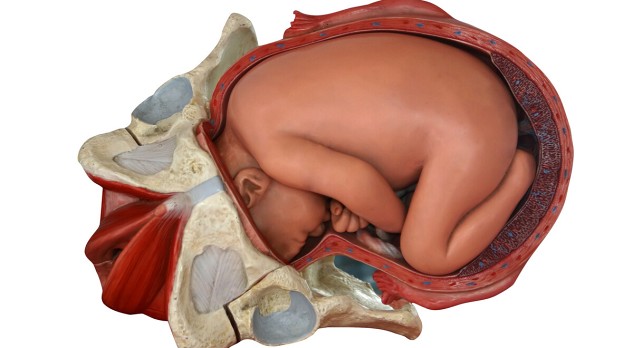 Beeldvorming van de uterus bij het placenta accreta spectrum 