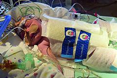 Een onverwacht slechte start bij de geboorte