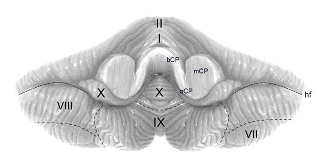 De niet-motorische aspecten van het cerebellum