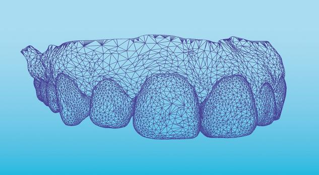 Inleiding tot de CAD/CAM-technologie in de tandheelkunde - deel 1