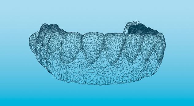 Inleiding tot de CAD/CAM-technologie in de tandheelkunde - deel 2